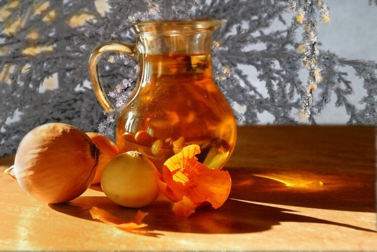 decotto di cipolla per la prostatite